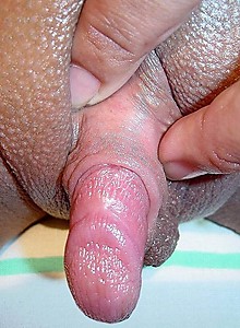 Join BarePass to view full images